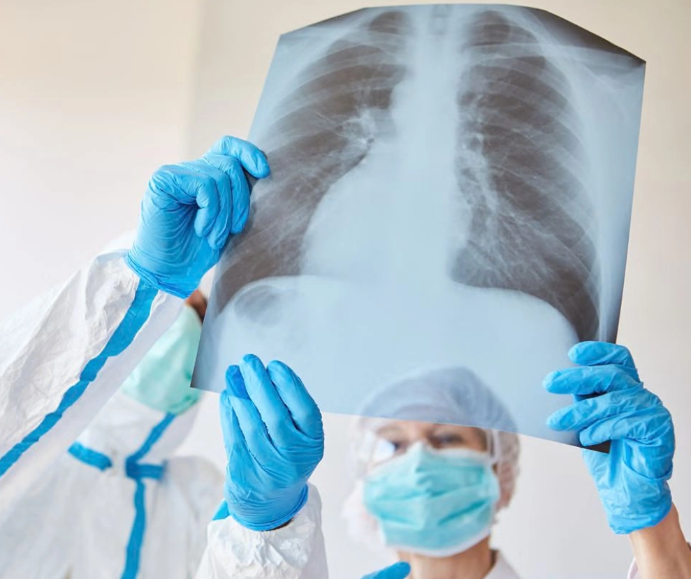 Risiko Pneumonia pada Jamaah Haji dan Umrah Masih Sering Diabaikan